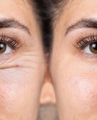 Do Lash Serums Age Your Eyes — featured image